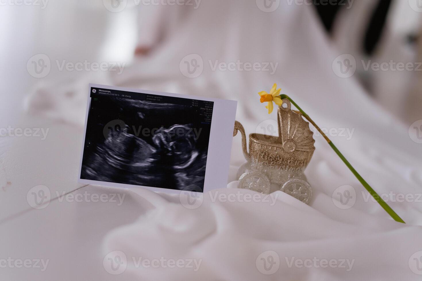 A photo of a baby in a stroller and a flower