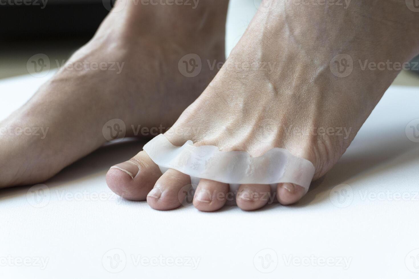 Bunion, hallux valgus. Silicone finger toe separator on feet isolated on white background. preparing for foot pedicure at home with nail separators photo