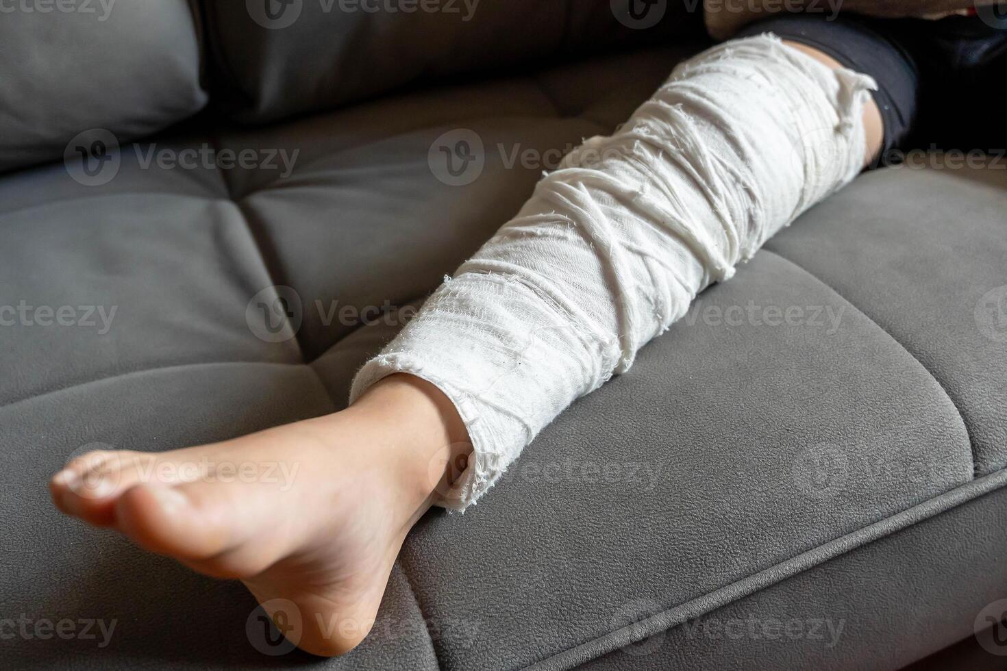 Child resting on sofa with bandaged leg after injury photo