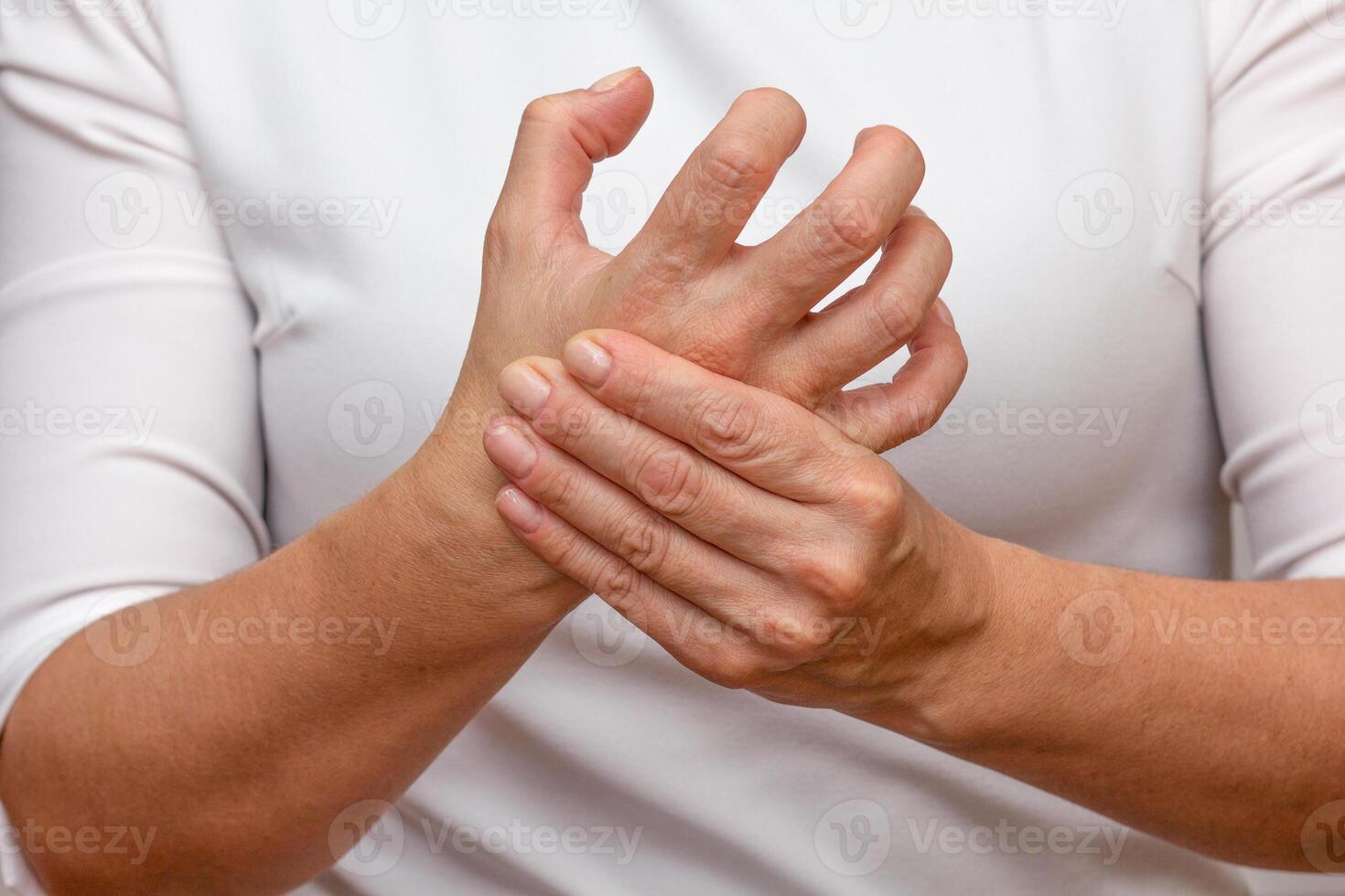 Woman hands showing hand with arthritis photo