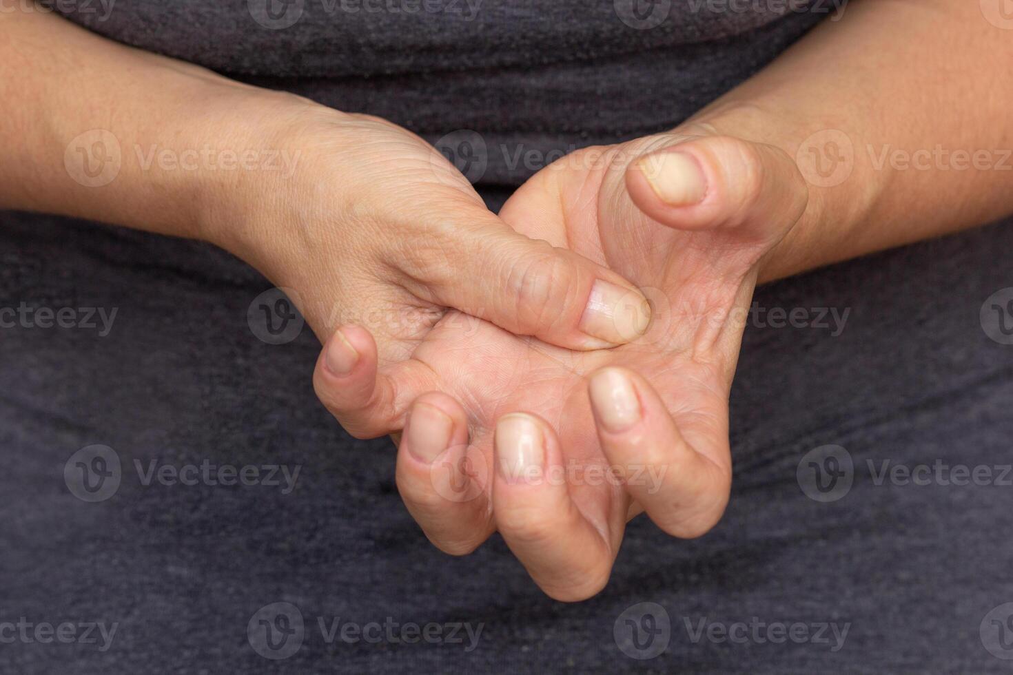 Woman hands showing numb hand photo