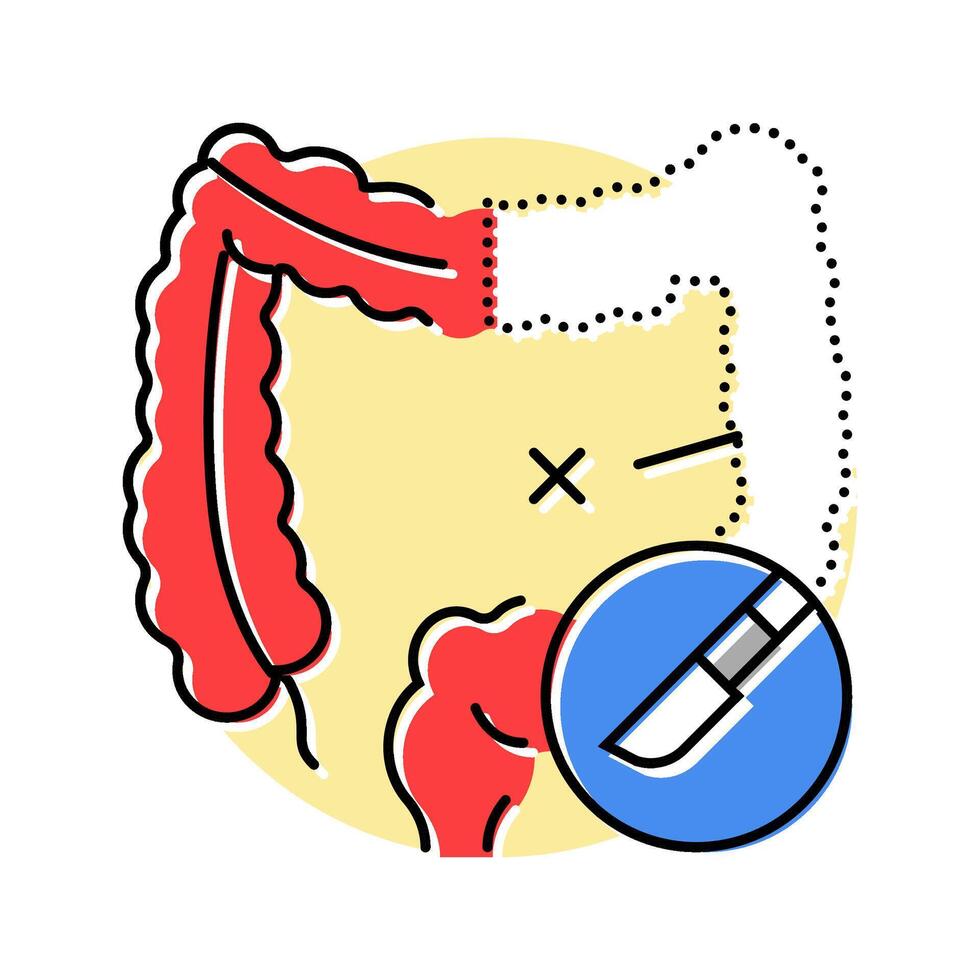 bowel resection surgery doctor color icon illustration vector