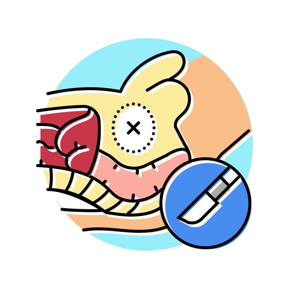 prostatectomy surgery hospital color icon illustration vector