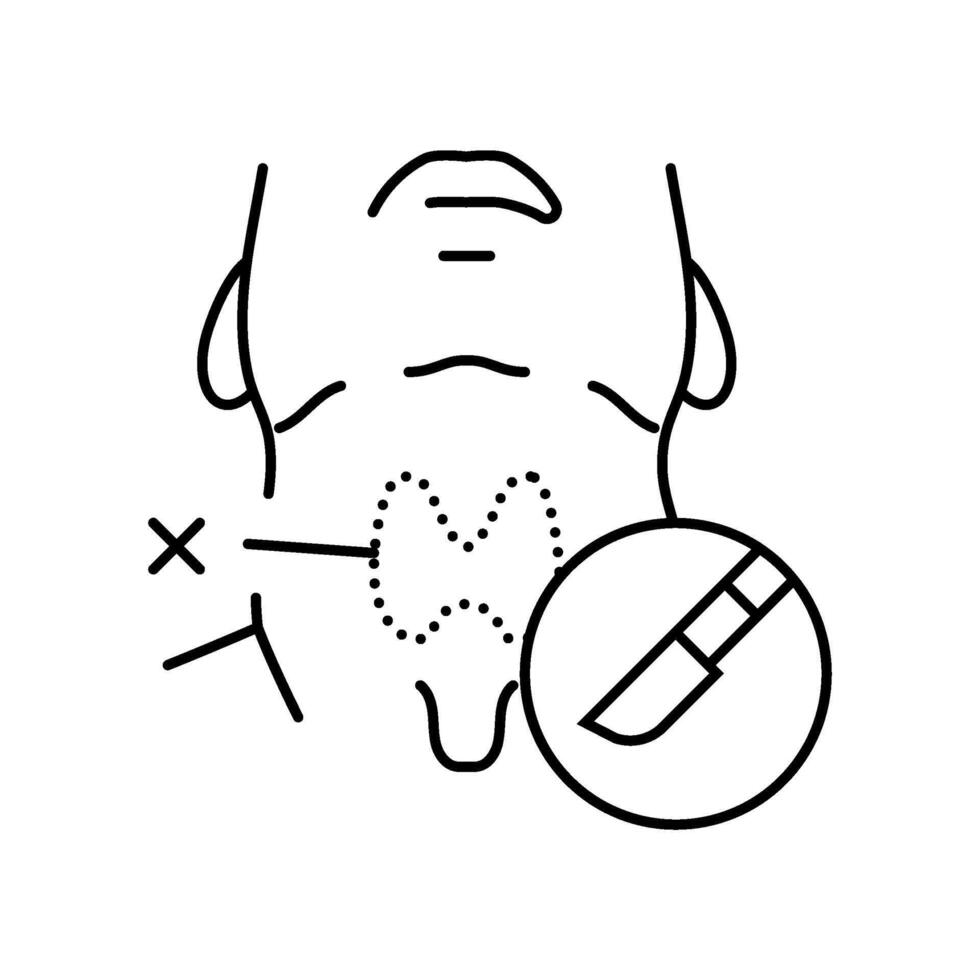 thyroidectomy surgery line icon illustration vector