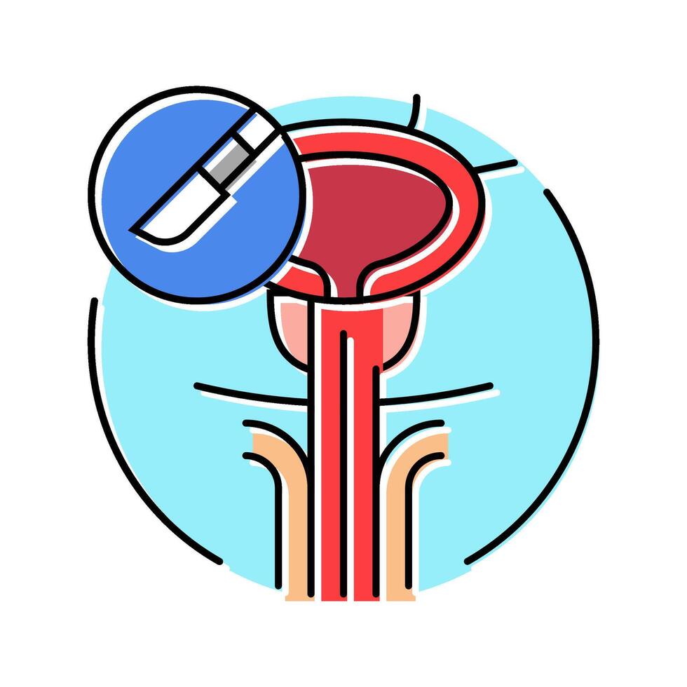 transurethral resection prostate surgery color icon illustration vector