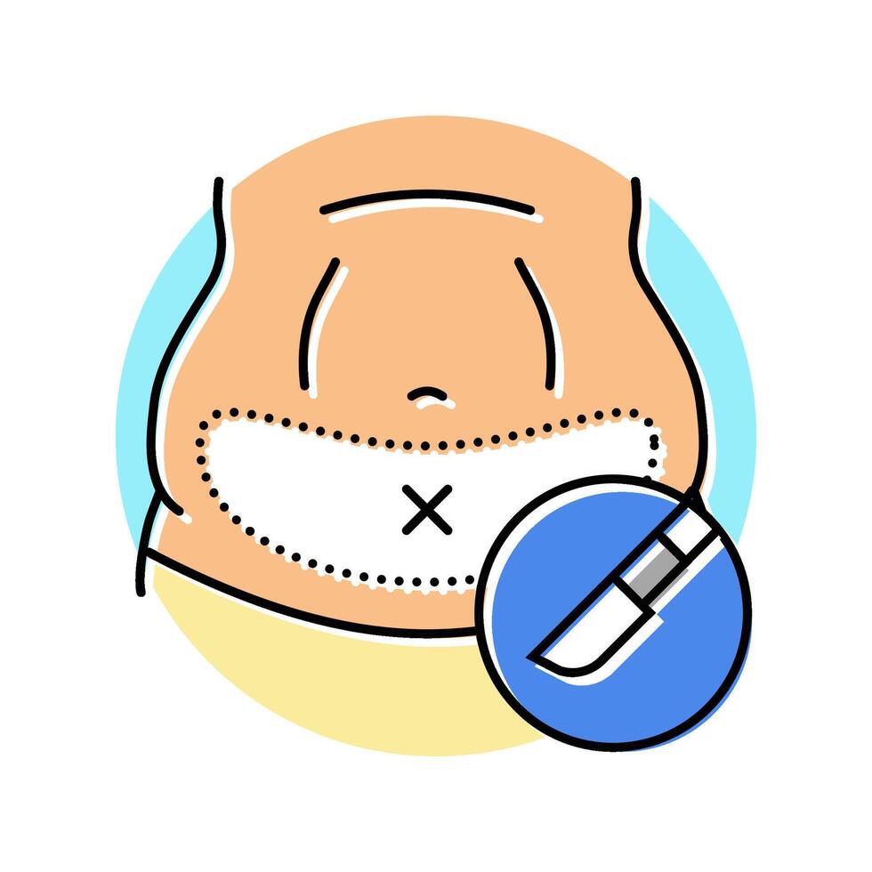 tummy tuck abdominoplasty surgery color icon illustration vector