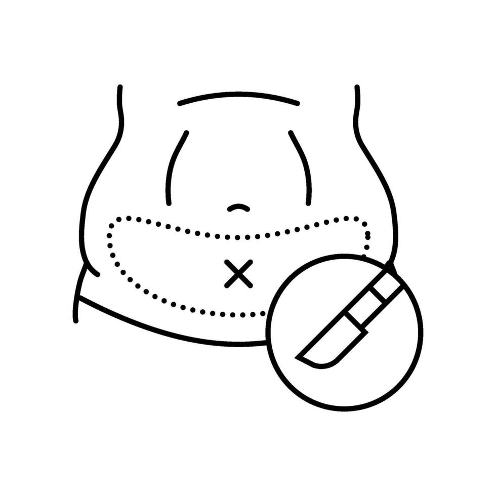 tummy tuck abdominoplasty surgery line icon illustration vector