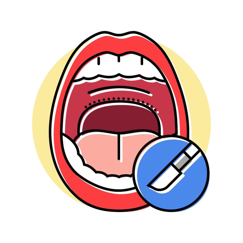 uvulopalatopharyngoplasty surgery color icon illustration vector