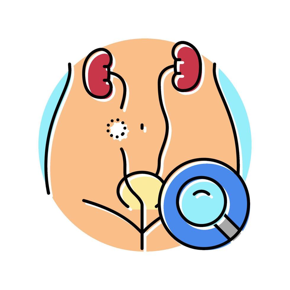 ureteroscopy surgery color icon illustration vector