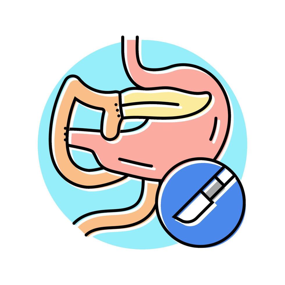 whipple procedure surgery color icon illustration vector