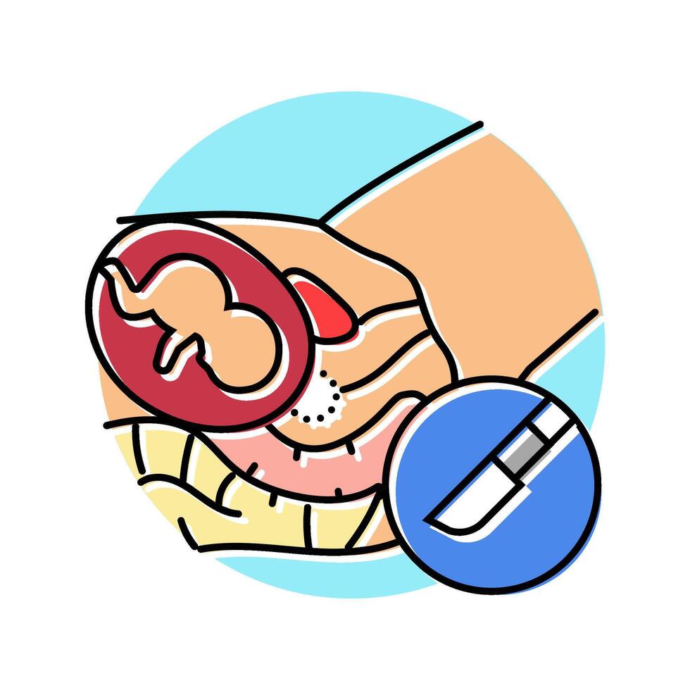 cervical cerclage surgery color icon illustration vector