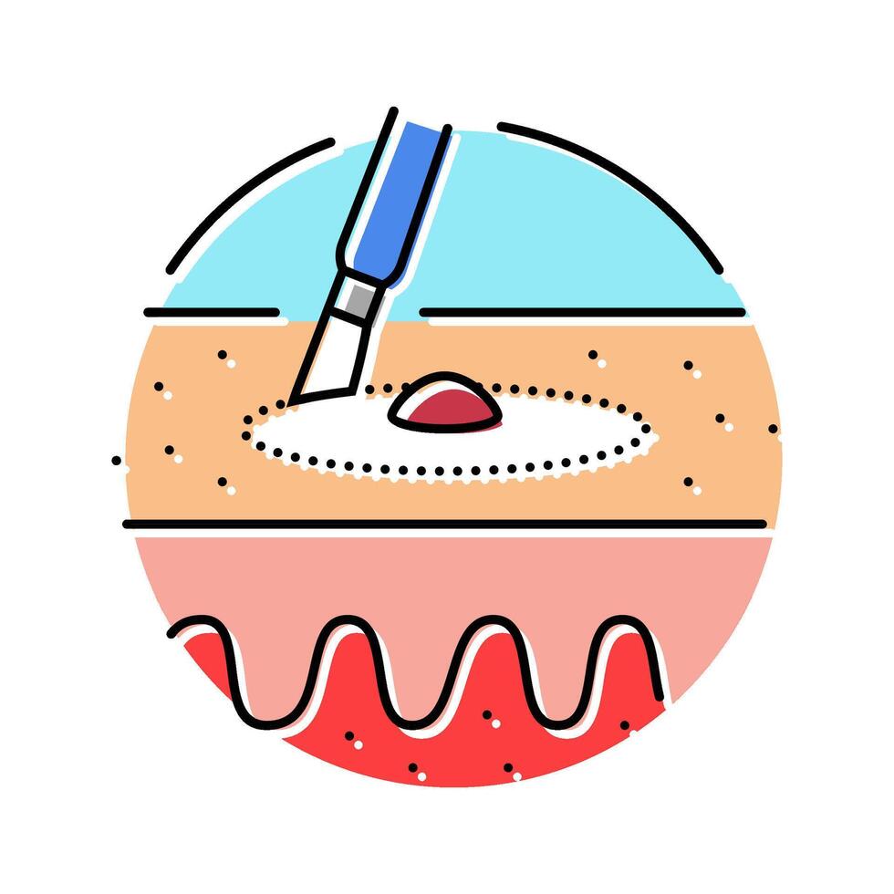 dilation and curettage surgery color icon illustration vector
