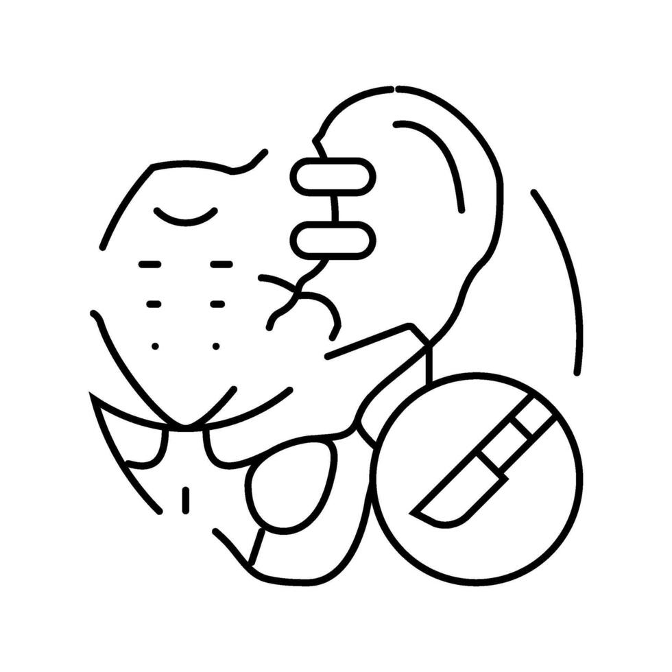 joint fusion surgery line icon illustration vector