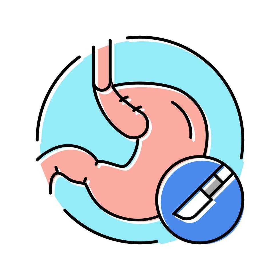 nissen fundoplication surgery color icon illustration vector