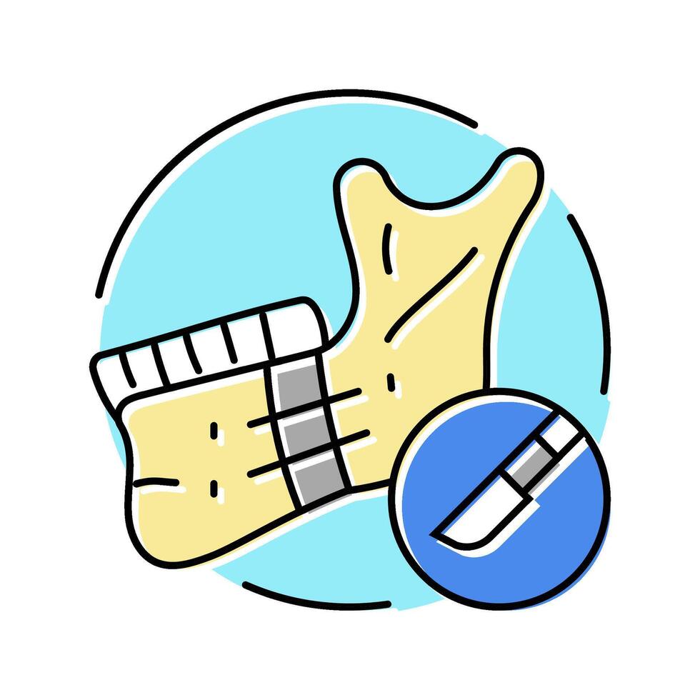 mandibular osteotomy surgery color icon illustration vector
