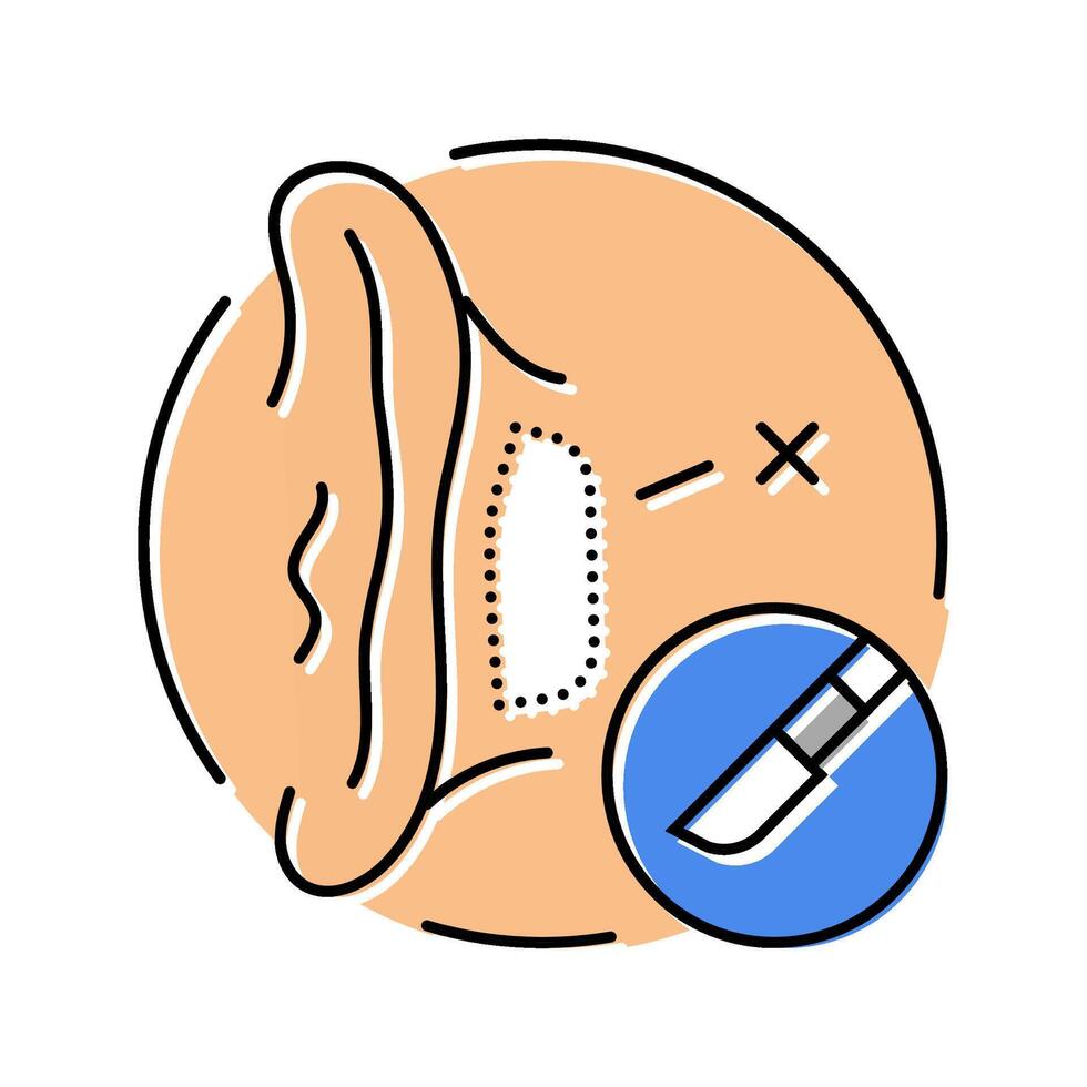 otoplasty surgery color icon illustration vector