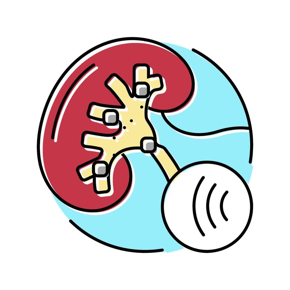 lithotripsy urology color icon illustration vector