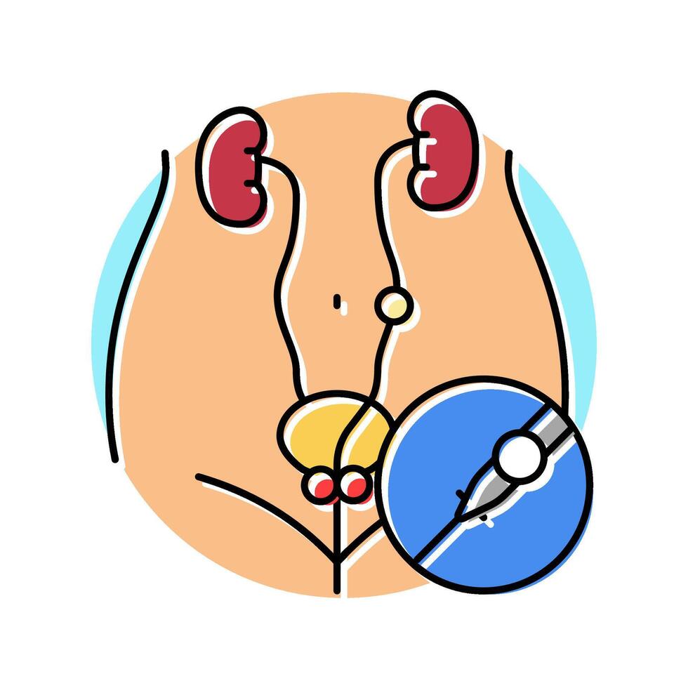 ureteroscopy urology color icon illustration vector