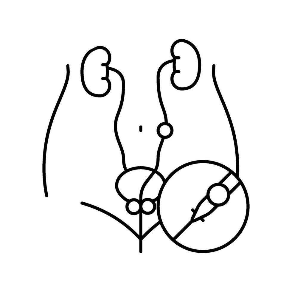 ureteroscopy urology line icon illustration vector