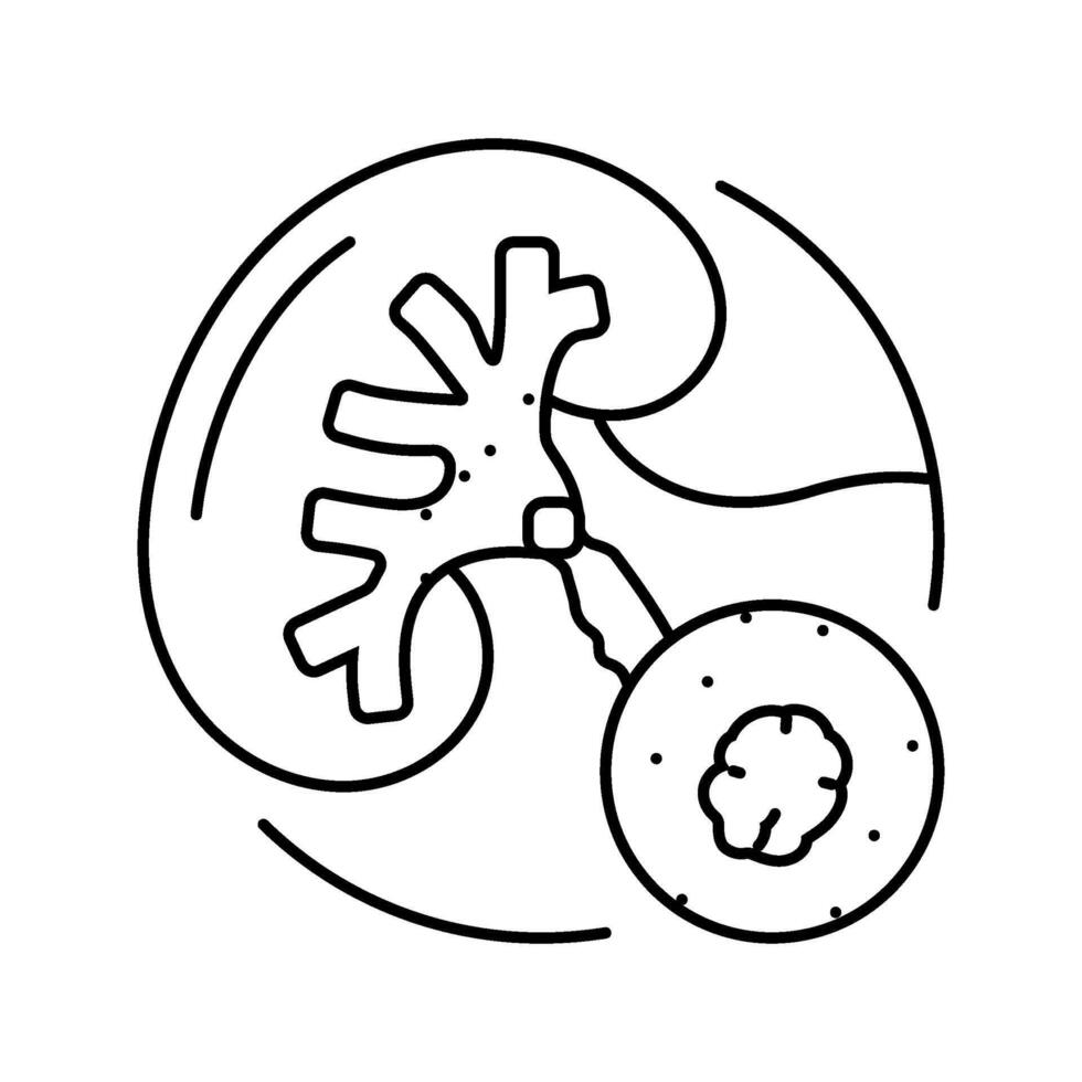 urolithiasis urology line icon illustration vector