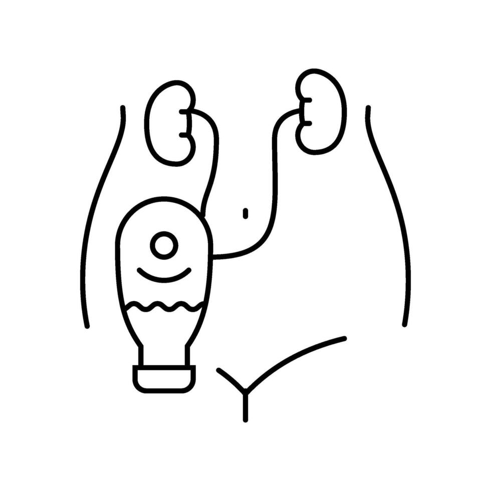 hydronephrosis urology line icon illustration vector