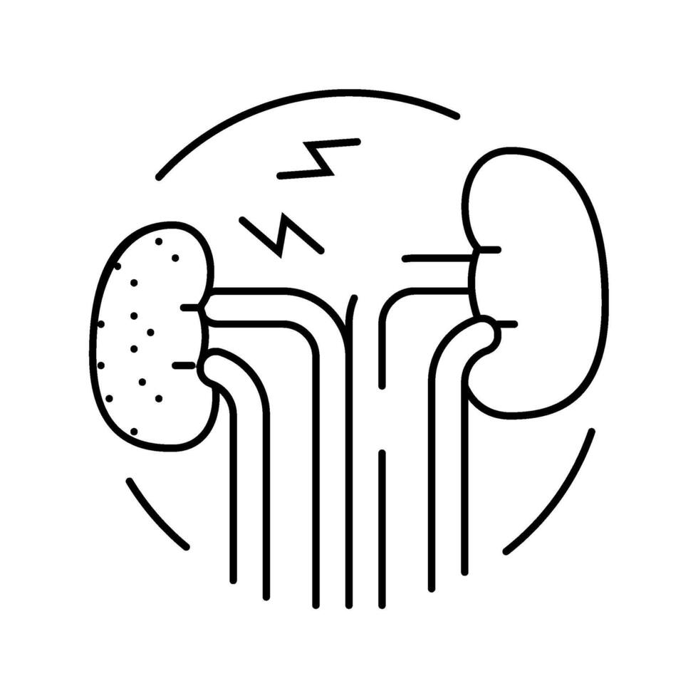 nephrectomy urology line icon illustration vector