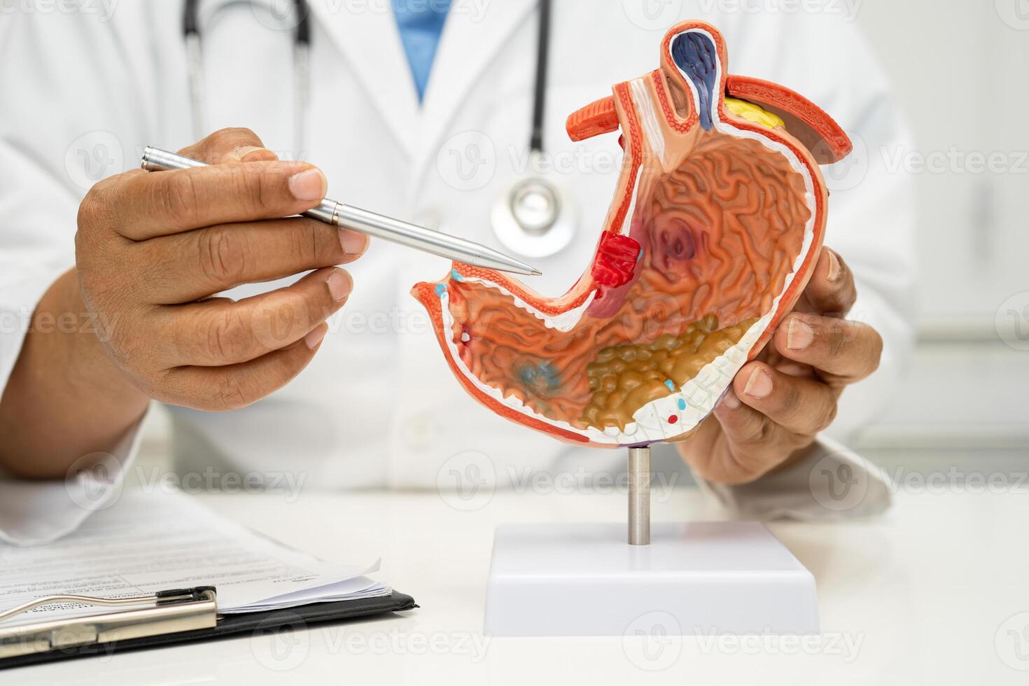 Stomach disease, doctor with human anatomy model for study diagnosis and treatment in hospital. photo