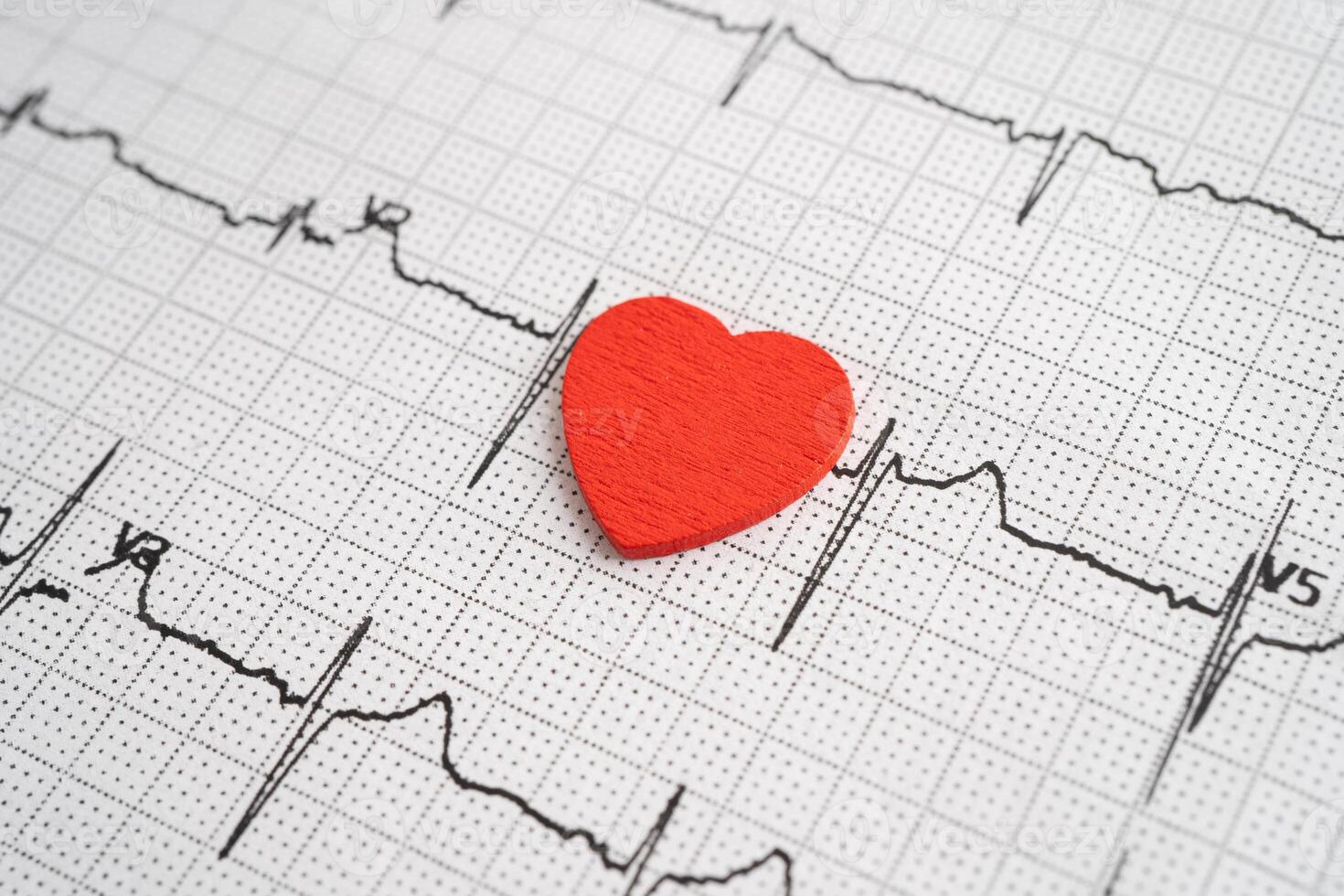 Red heart on electrocardiogram ECG with red heart, heart wave, heart attack, cardiogram report. photo