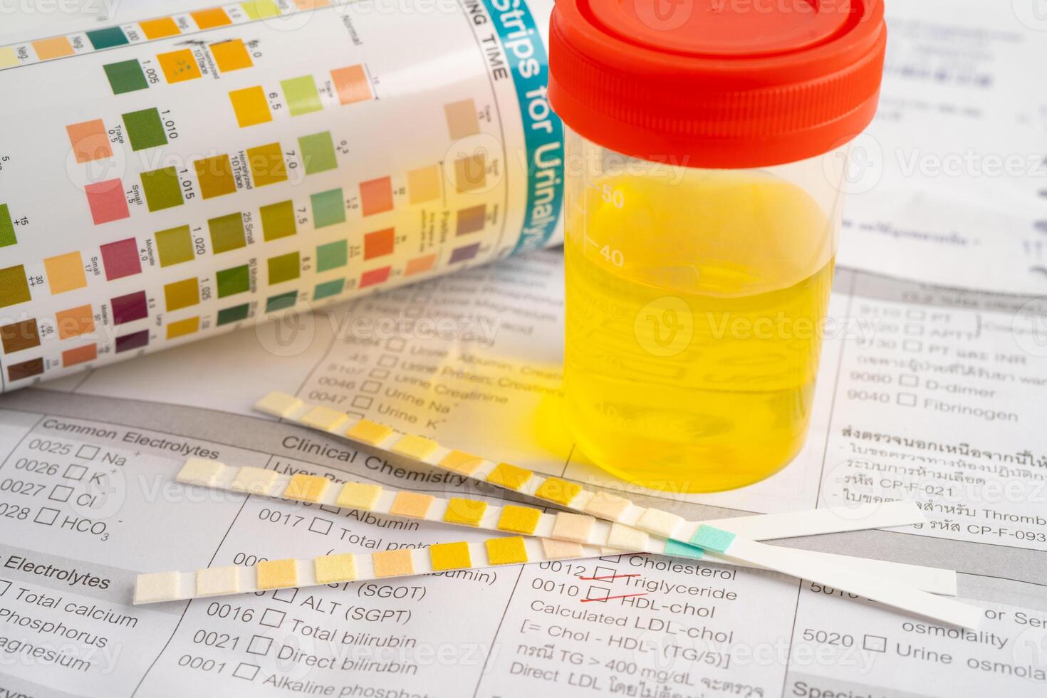 Urinalysis, urine cup with reagent strip pH paper test and comparison chart in laboratory. photo