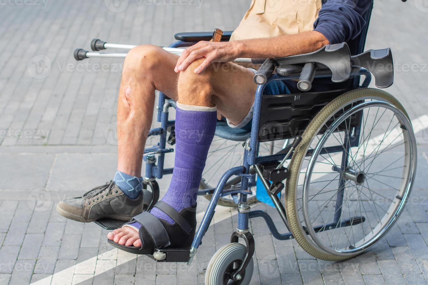 middle-aged Caucasian man sits in a wheelchair with a cast on his broken leg, holding crutches in his hands,concept of two possible modes of movement for person, photo