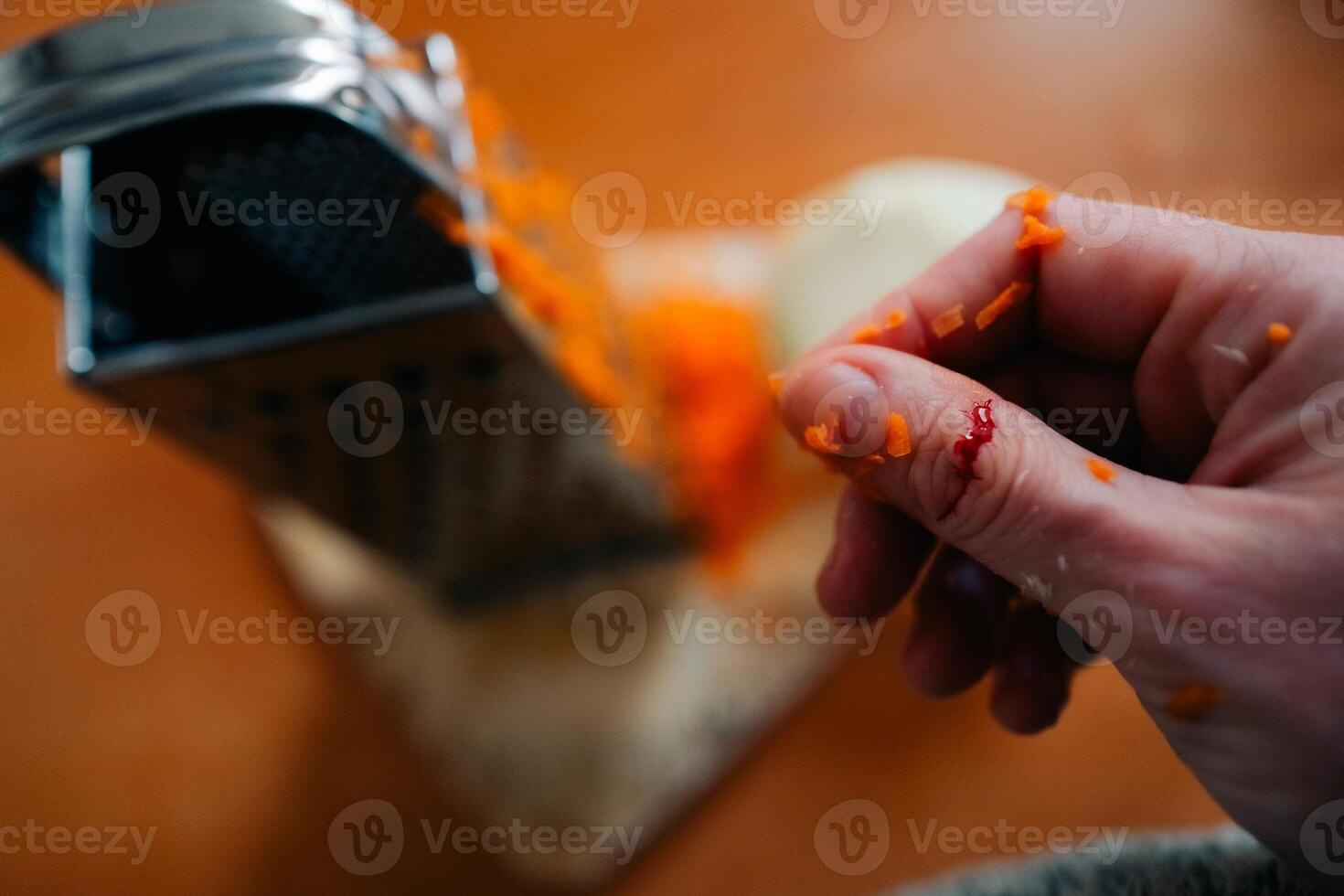 A woman cut her finger until it bled on a grater while cooking dinner. photo
