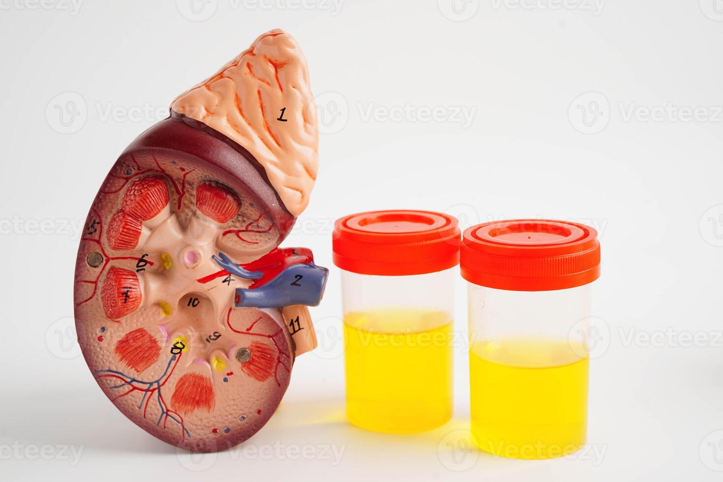 Urinalysis, Kidney and urine cup for check health examination in laboratory. photo
