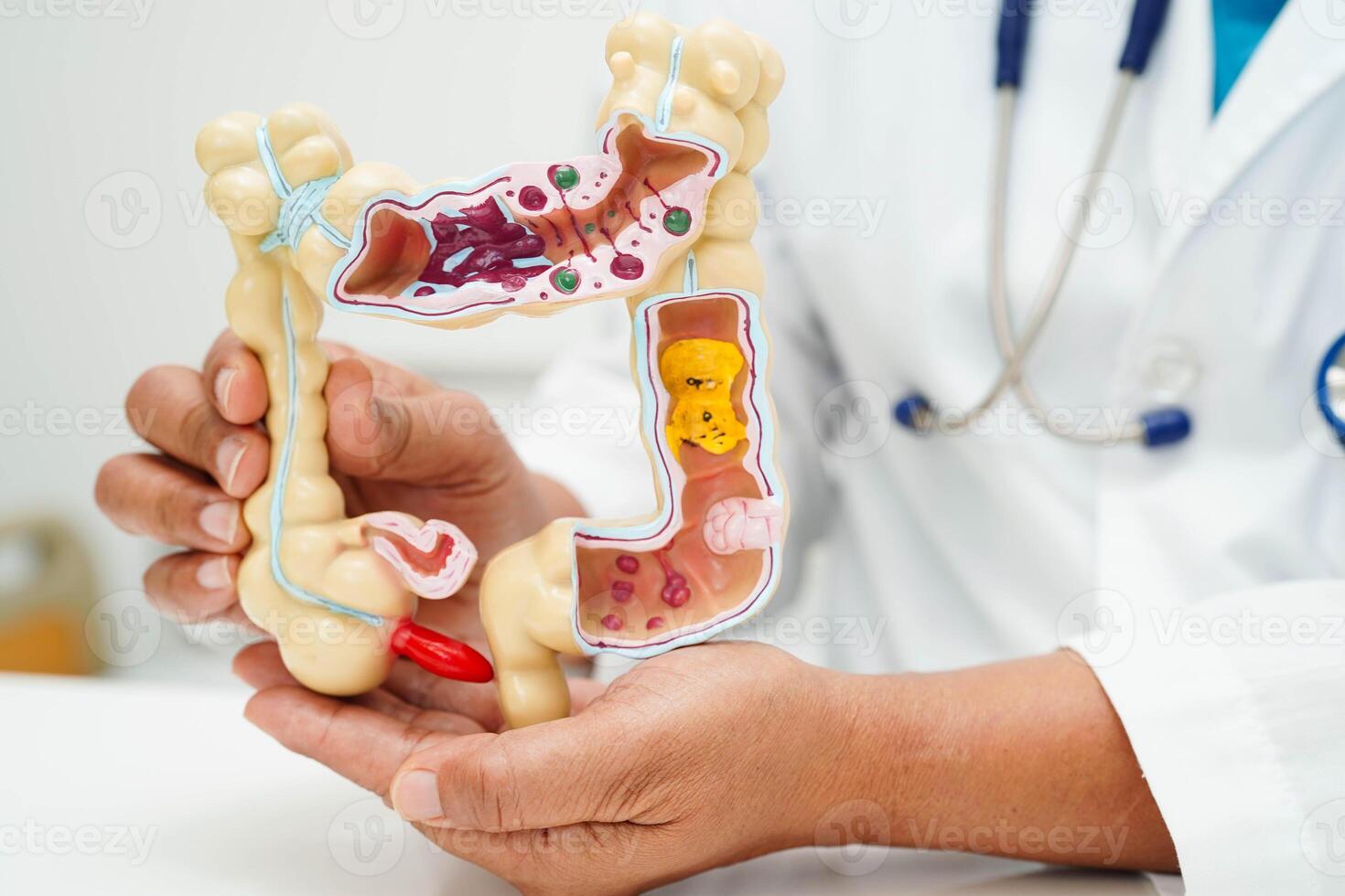 Intestine, doctor holding human anatomy model for study diagnosis and treatment in hospital. photo