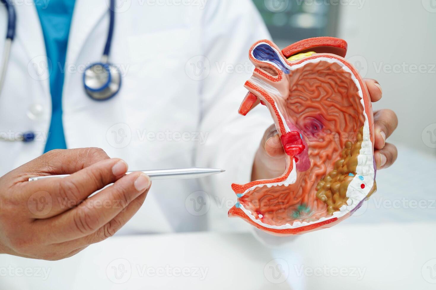 Stomach disease, doctor holding anatomy model for study diagnosis and treatment in hospital. photo