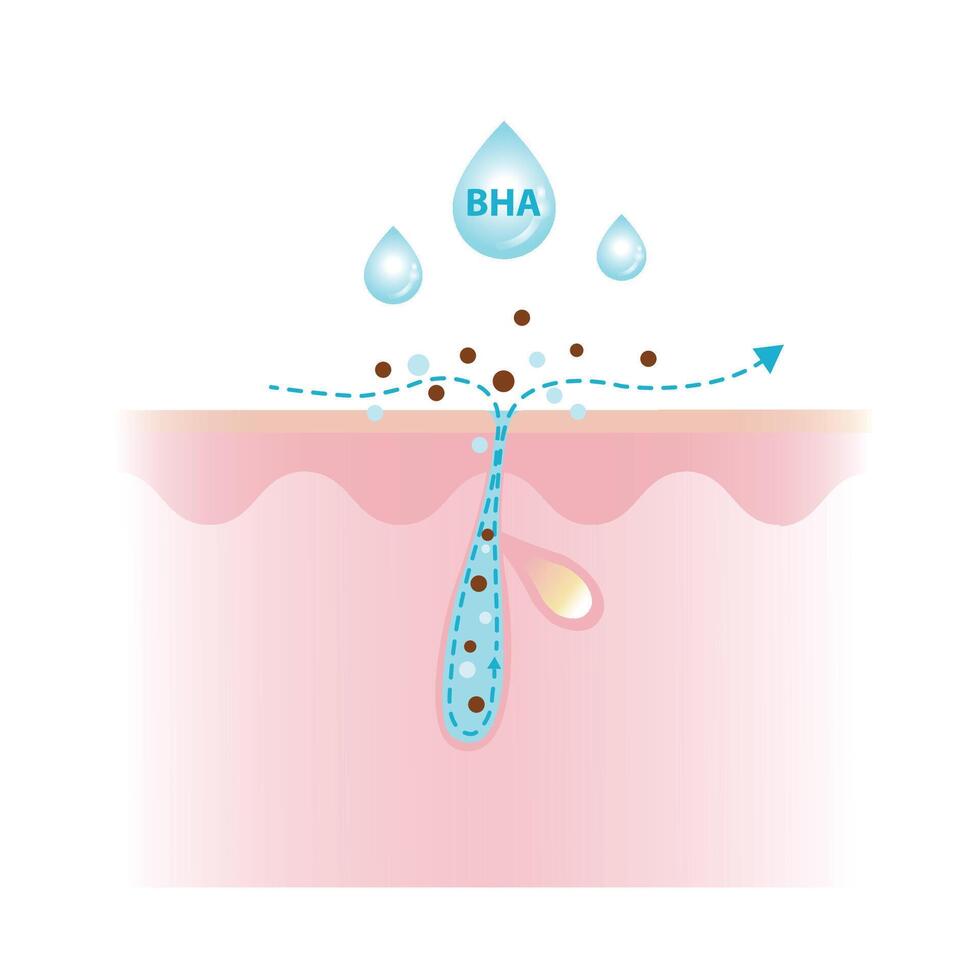 Beta Hydroxy Acids characteristics illustration on white background. BHA penetrate deep into the pore, unclogs, dissolving excess oil, debris and oil soluble. Skin care and beauty concept. vector