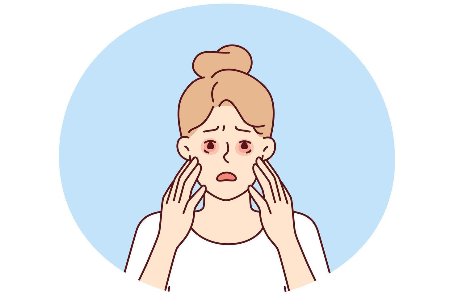 Sad woman with dry reddened eyes due to irritation or allergic reaction caused by food vector