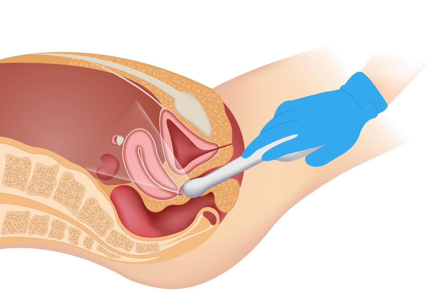 Transvaginal ultrasound scanner of the internal pelvic organs. The concept of women's health vector