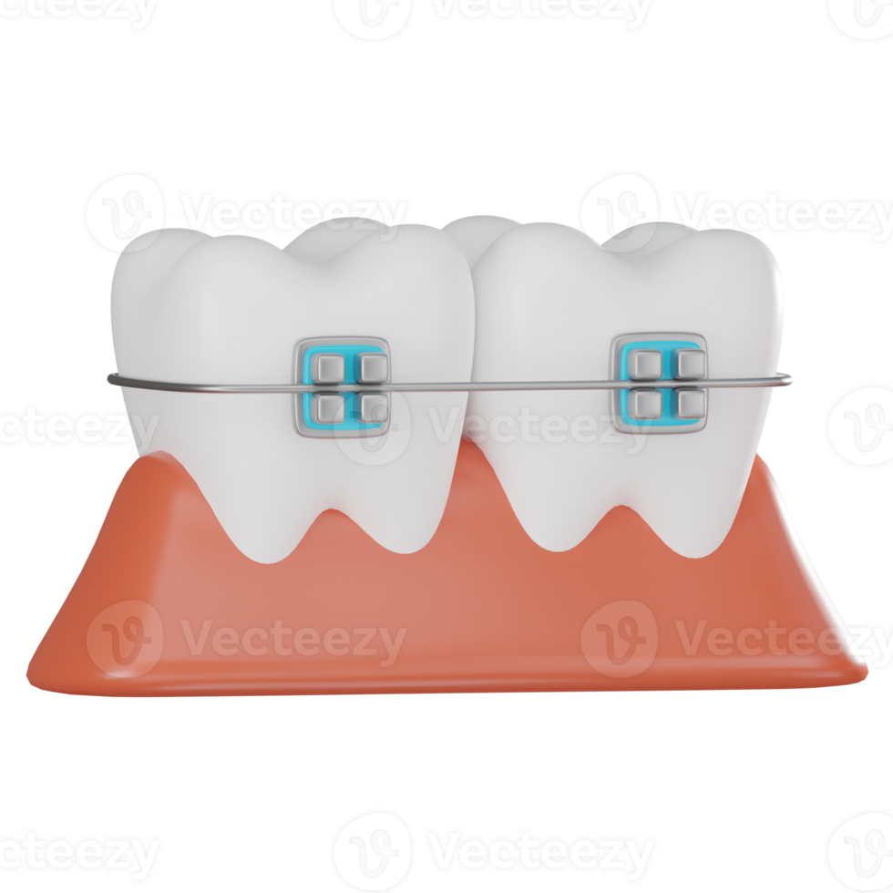 3D Render Teeth with Braces on Gums Illustration Icon png