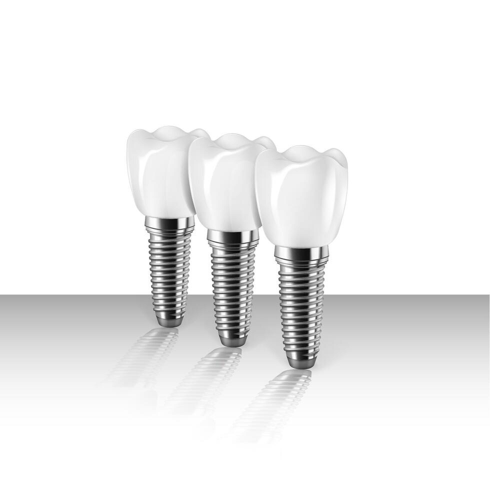 3D Dental implants with reflection. The concept of prosthetics in dentistry vector