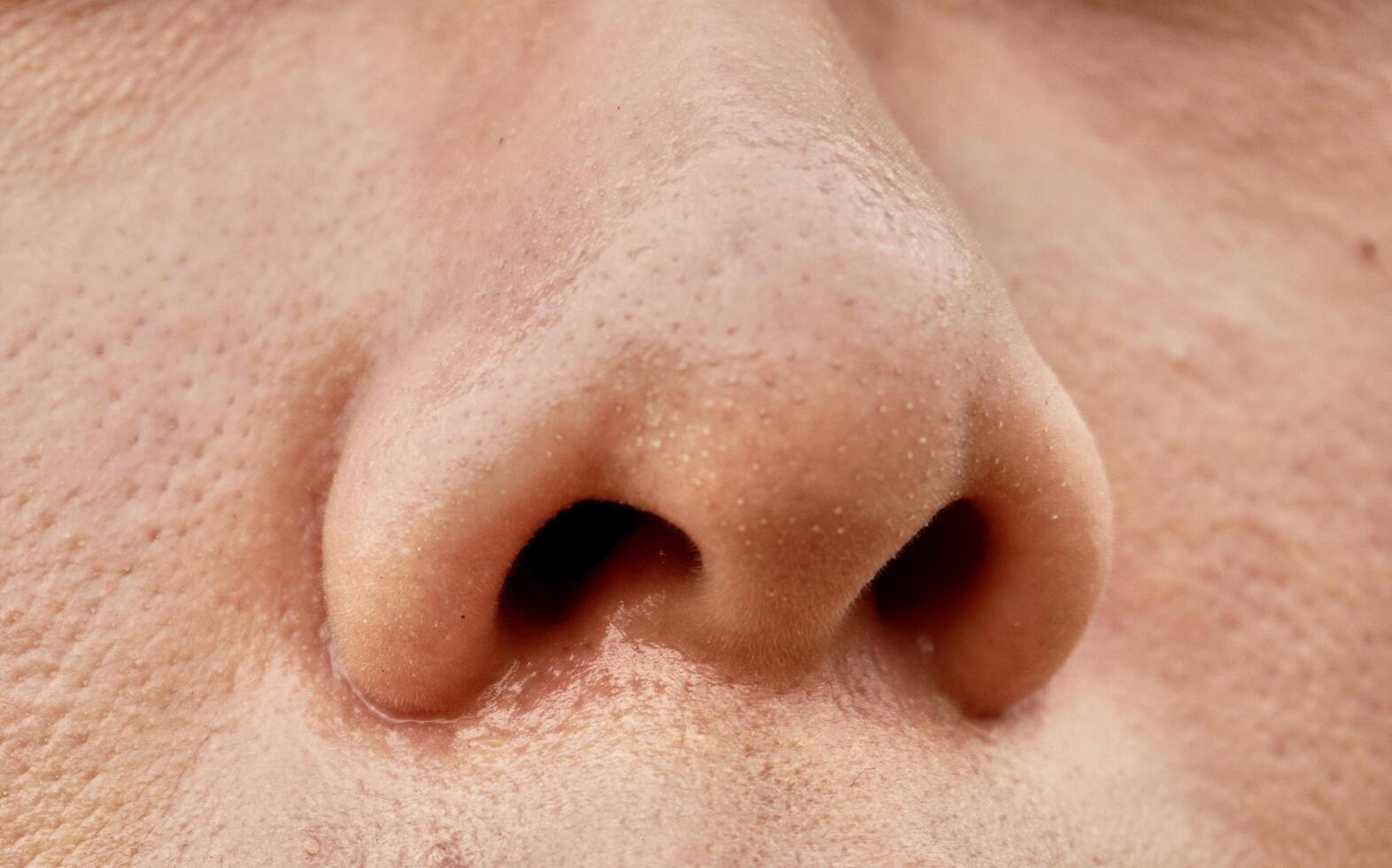 Close up human nose with oily skin and blackheads comedo on pores isolated on horizontal ratio bare face texture background. photo