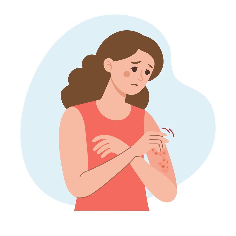 Woman scratches her hand. Allergic itching, skin inflammation, redness and irritation. Atopic dermatitis, eczema, psoriasis. vector