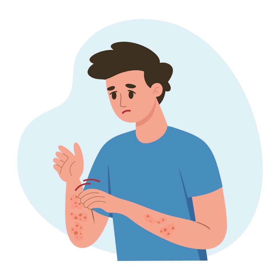 Man scratching his hand. Allergic itching, skin inflammation, redness and irritation. Atopic dermatitis, eczema, psoriasis. Healthcare and medicine. vector