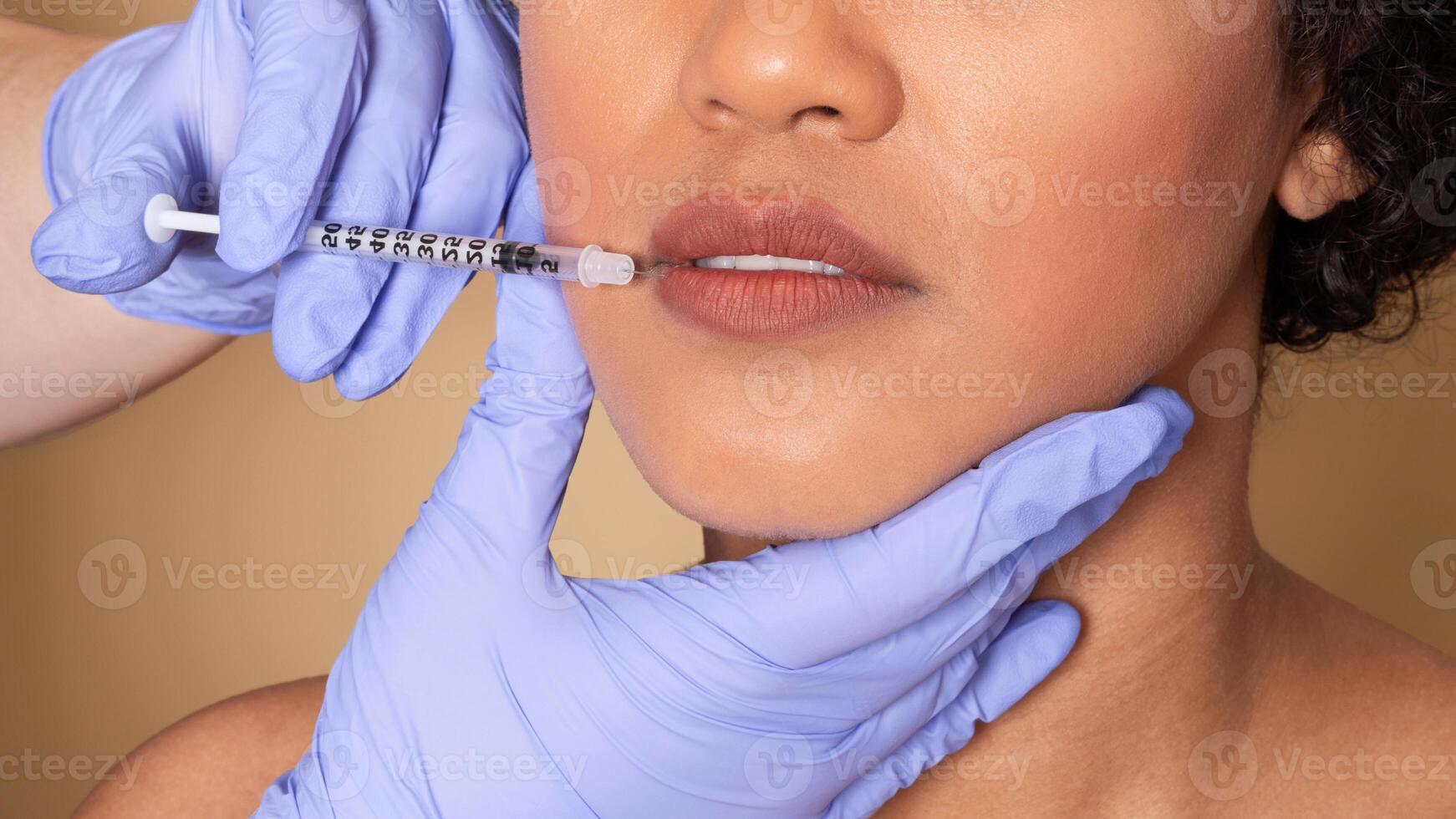 A professional performs a lip enhancement procedure on a client, using a syringe for injectable filler. The clinic environment is clean and focused on beauty treatments. photo
