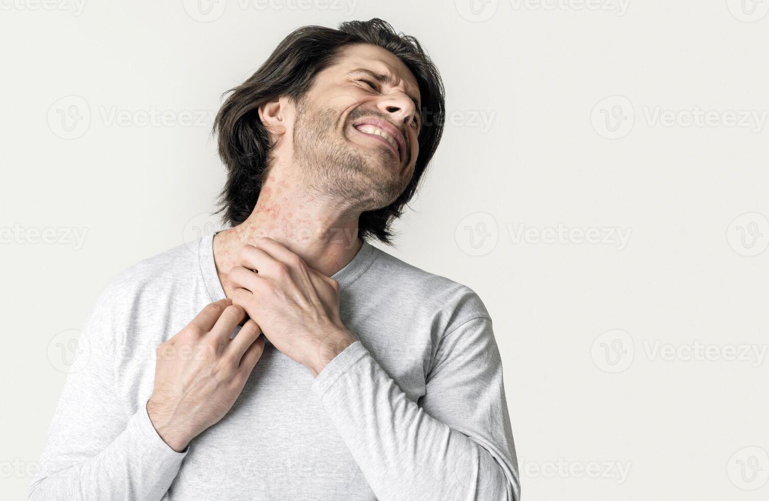 Eczema concept. Man suffers from skin irritation isolated on gray background photo