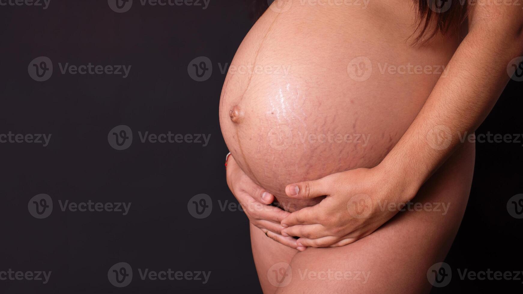 close-up of a pregnant belly with stretch marks on the skin. pregnancy concept of female body changes photo