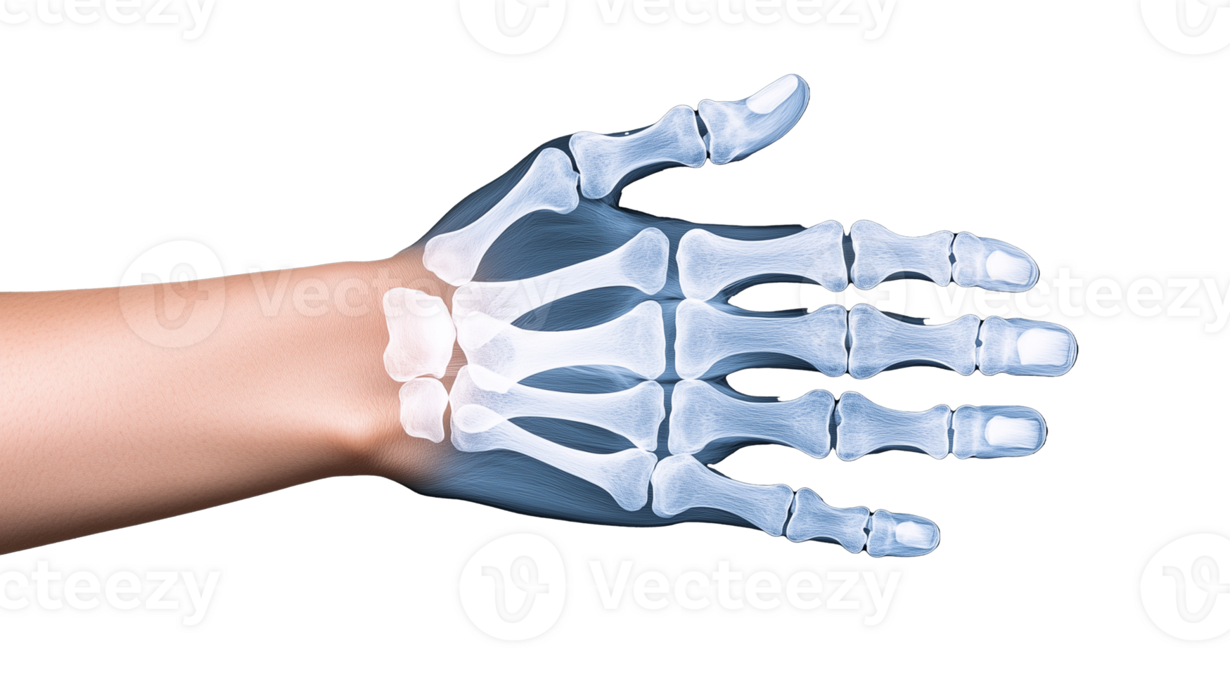 X-ray image of a human hand skeleton with transparent background png
