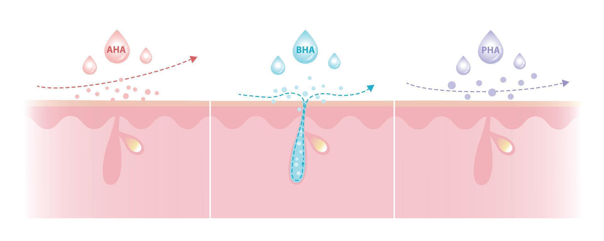 Comparison of Alpha, Beta, Poly Hydroxy Acids characteristics illustration. AHA exfoliate the surface skin. BHA penetrate deep into the pore. PHA dissolve the surface, large molecule, penetrate less. vector