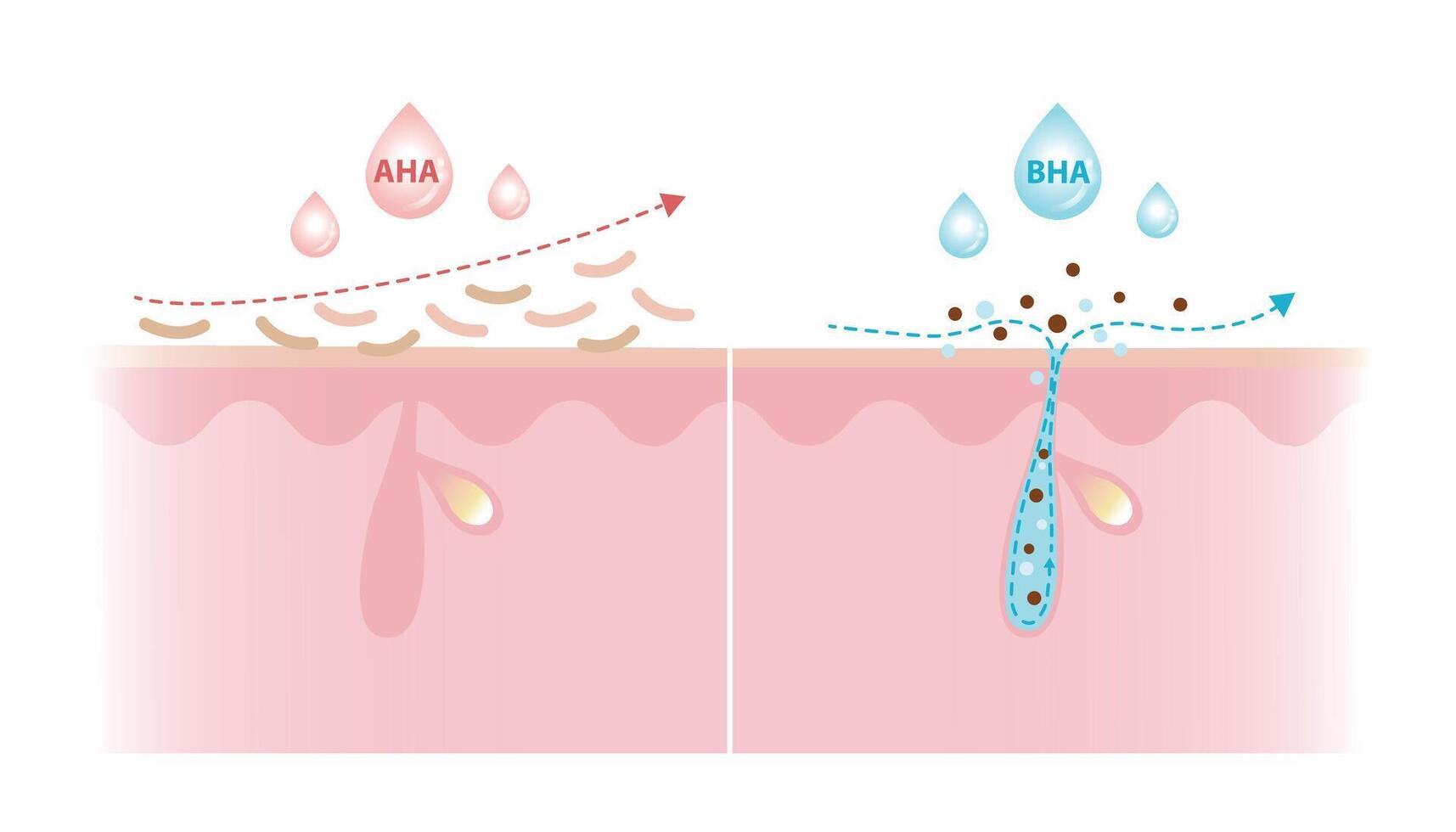 Alpha Hydroxy Acids and Beta Hydroxy Acids characteristics illustration on white background. AHA exfoliate the surface skin and water soluble. BHA penetrate deep into the pore and oil soluble. vector
