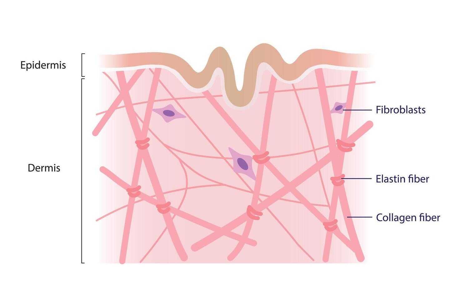 Cross section of low density of collagen, elastin fibers and fibroblasts in the dermis layer illustration on white background. Formation of aging and wrinkled. Skin care and beauty concept. vector