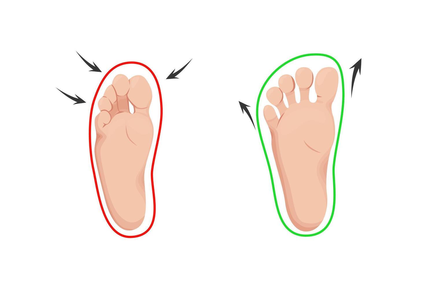 Barefoot shoes care infographic. Orthopedic and anatomical shoes. compare healthy and deformity feet. vector